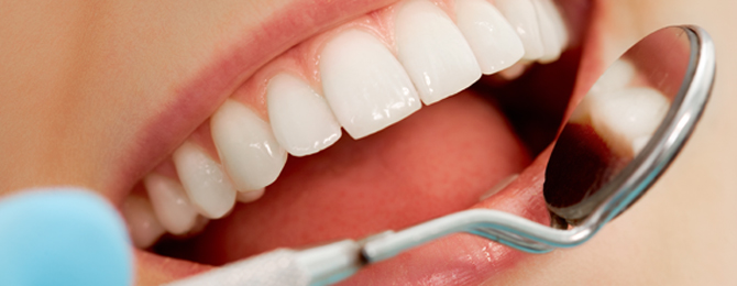 Frühe Anzeichen von Zahnfleischproblemen erkennen
